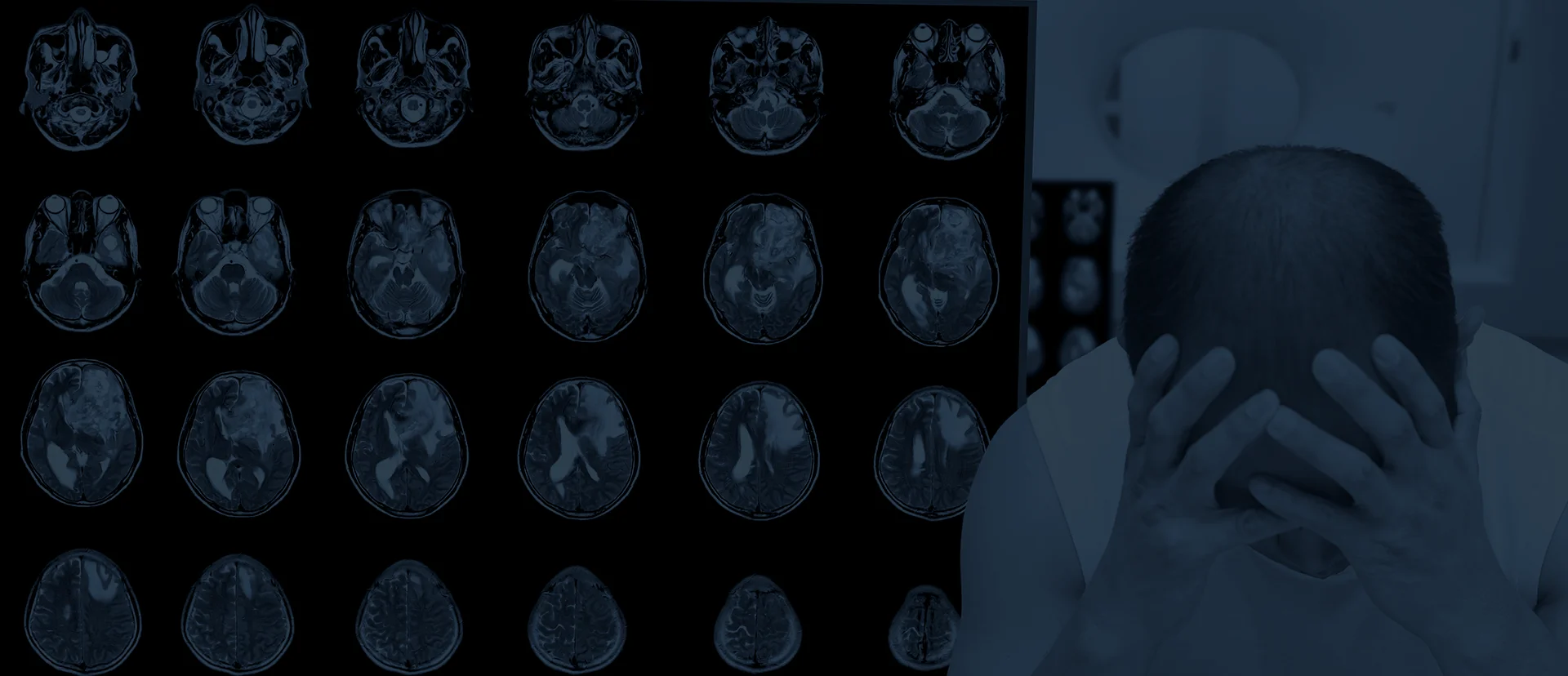 Brain MRI scans and medical imagery representing traumatic brain injury diagnosis